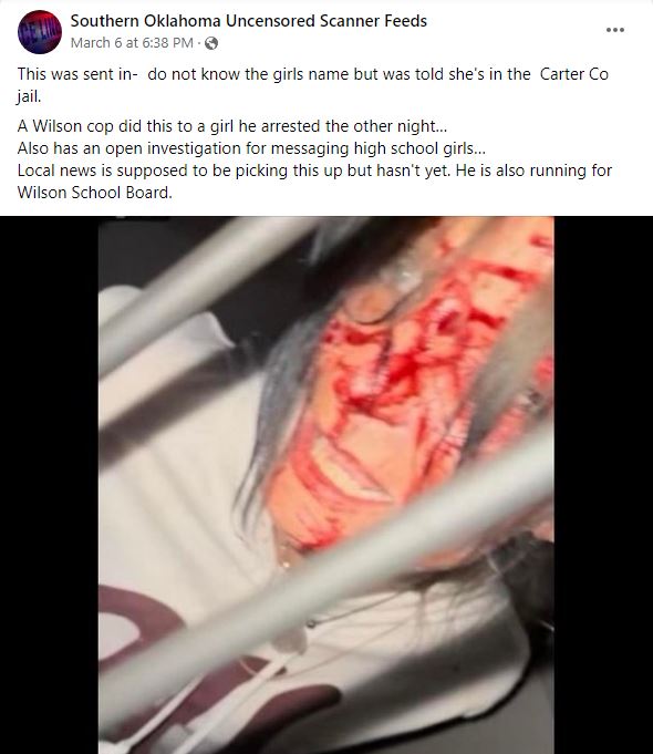 This was sent in-  do not know the girls name but was told she's in the  Carter Co jail.  A Wilson cop did this to a girl he arrested the other night… Also has an open investigation for messaging high school girls… Local news is supposed to be picking this up but hasn't yet. He is also running for Wilson School Board.